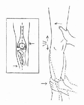 膝关节韧带损伤 (4)