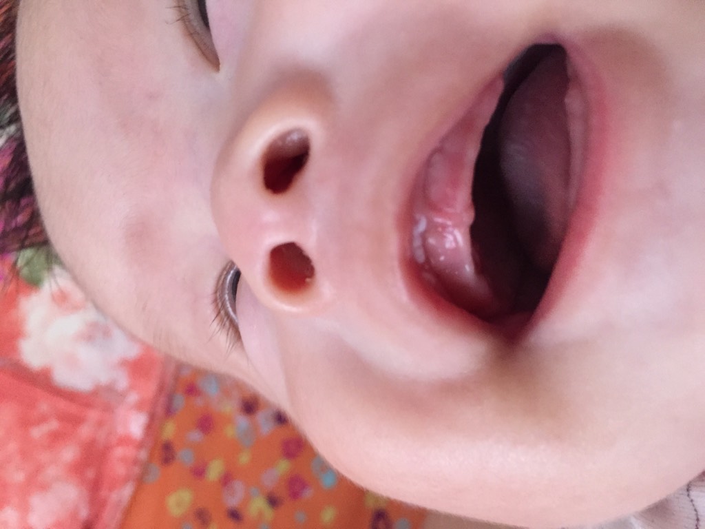 婴儿马牙图片 (12)