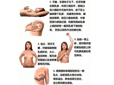 乳腺增生按摩治疗方法 (39)