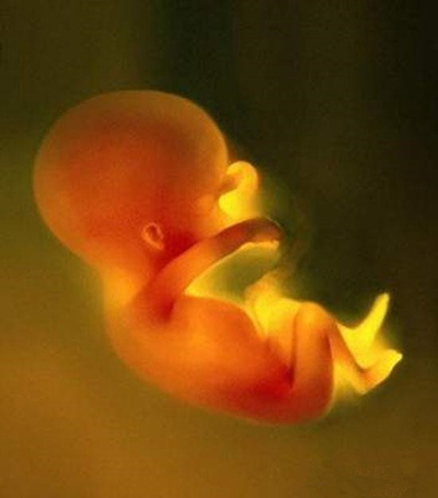 胎儿在肚子里的姿势 (19)