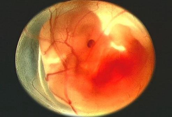 胎儿在肚子里的姿势 (11)