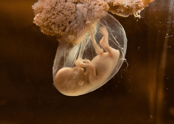 胎儿在肚子里的姿势 (2)