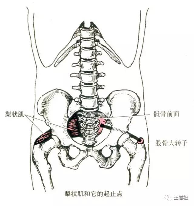 一塊小肌肉引起的大問題——梨狀肌綜合徵