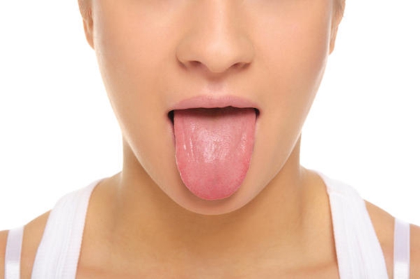舌炎的症状图片 (40)