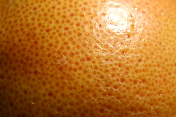 橘子皮状皮肤图片