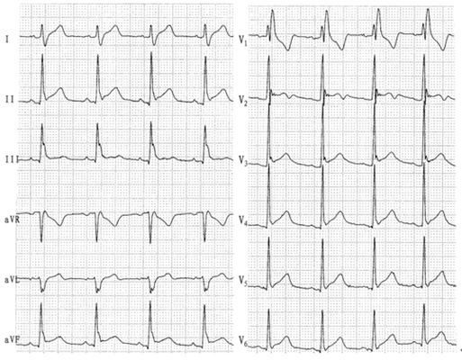 心电图异常 (49)