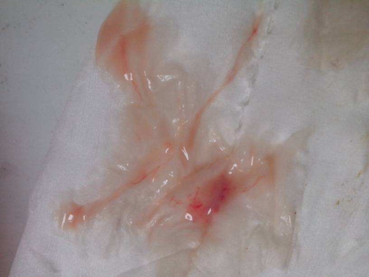 排卵期白带带血的图片图片