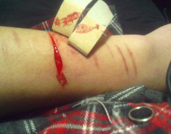 刀片割手臂流血的照片图片