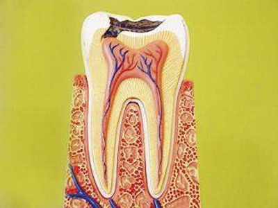 牙髓炎图片 (9)