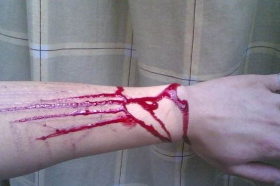 手臂割伤图片真实流血图片