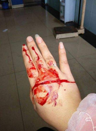 女孩手割出血照片图片