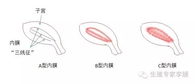 内膜 www.youlai.cn