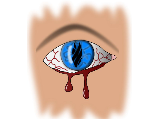 眼睛流血图片 (2)
