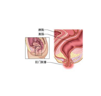 肠脂垂的部位图片