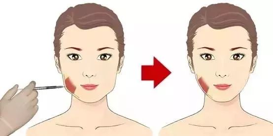 一, 如何知道咬肌大不大?