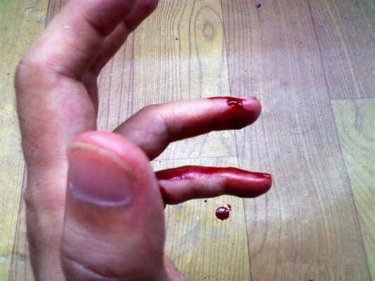 手指头流血图片图片