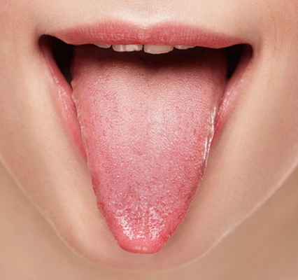 舌头颜色发紫图片胃癌图片