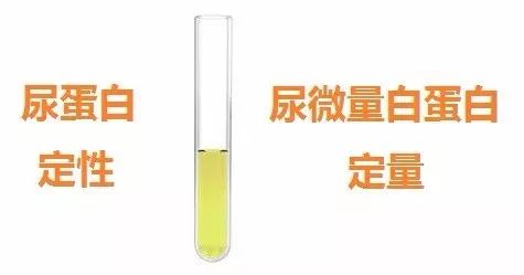 为什么要检查尿微量白蛋白