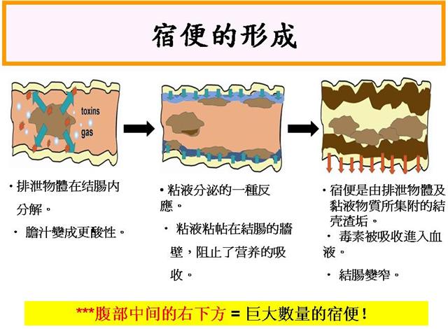 1.宿便會阻礙營養吸收,也壓迫小腸絨毛的活力及彈性