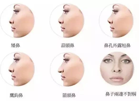 你的鼻子是什么类型的?