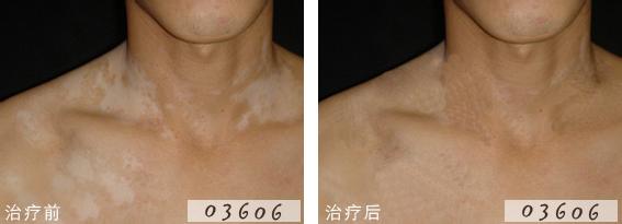 u=2383903080,856090098&fm=21&gp=0.jpg