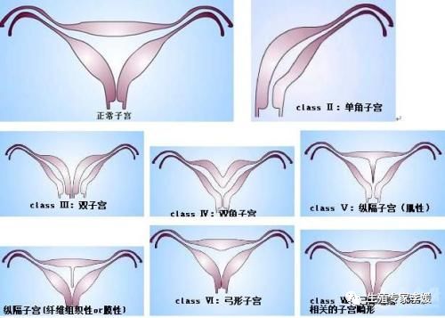 子宫内膜薄是由哪些方面引起的