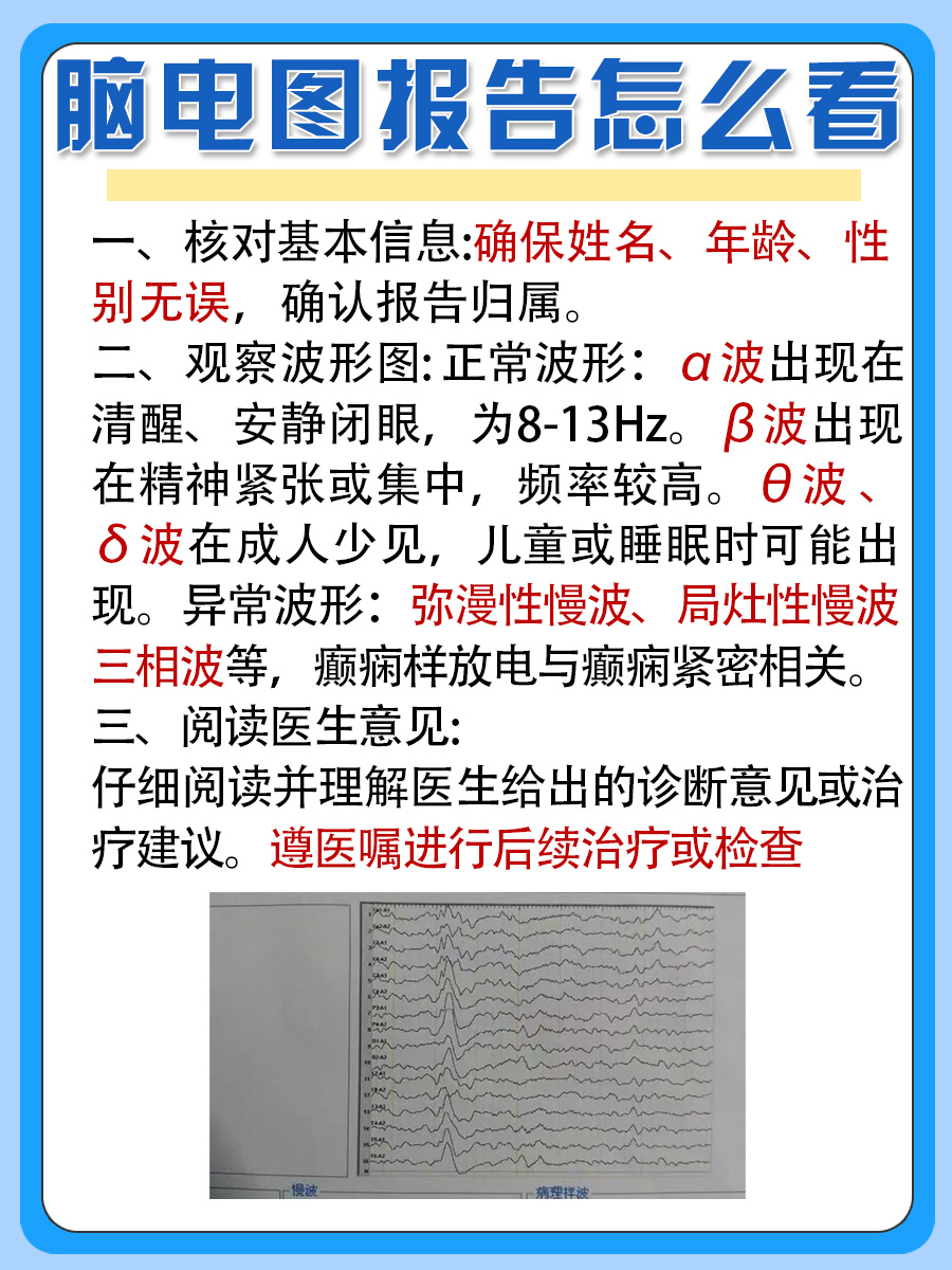 医生教你如何get脑电图报告要点~