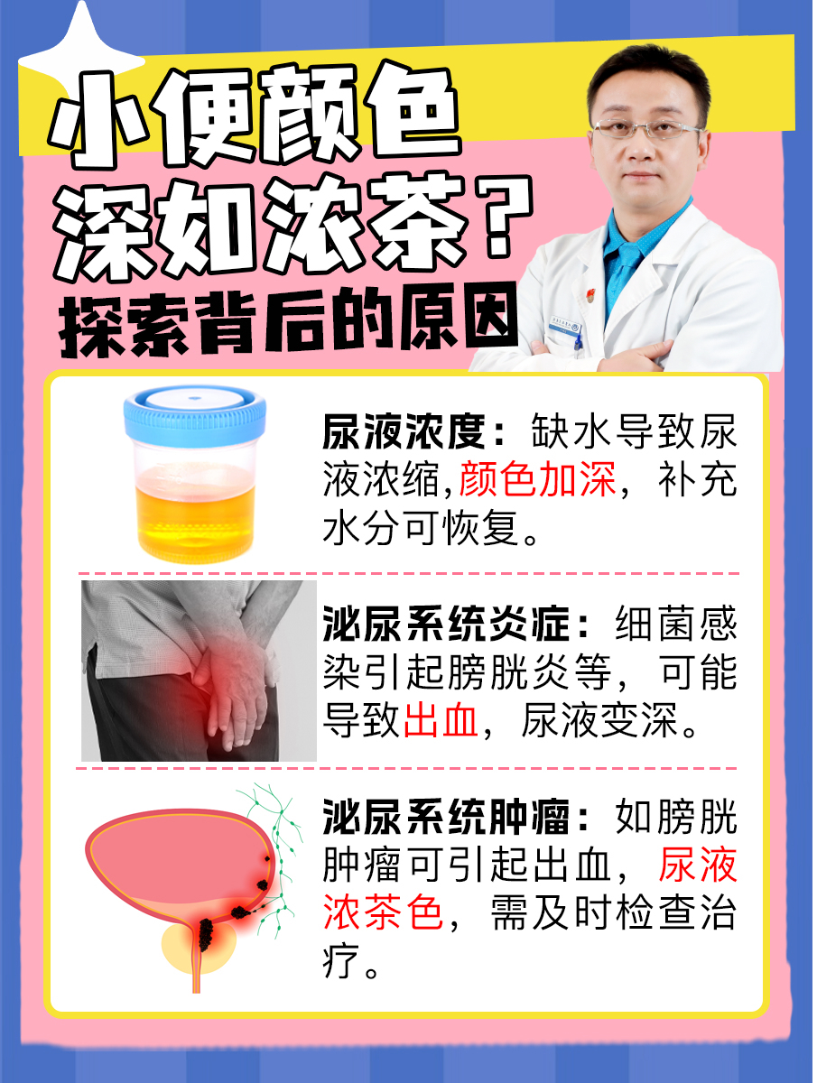 小便颜色深如浓茶?探索背后的原因