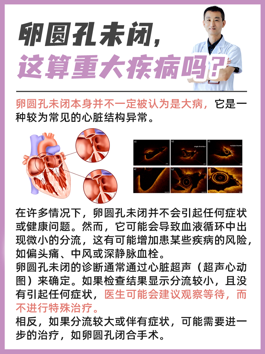 卵圆孔未闭，这算重大疾病吗？