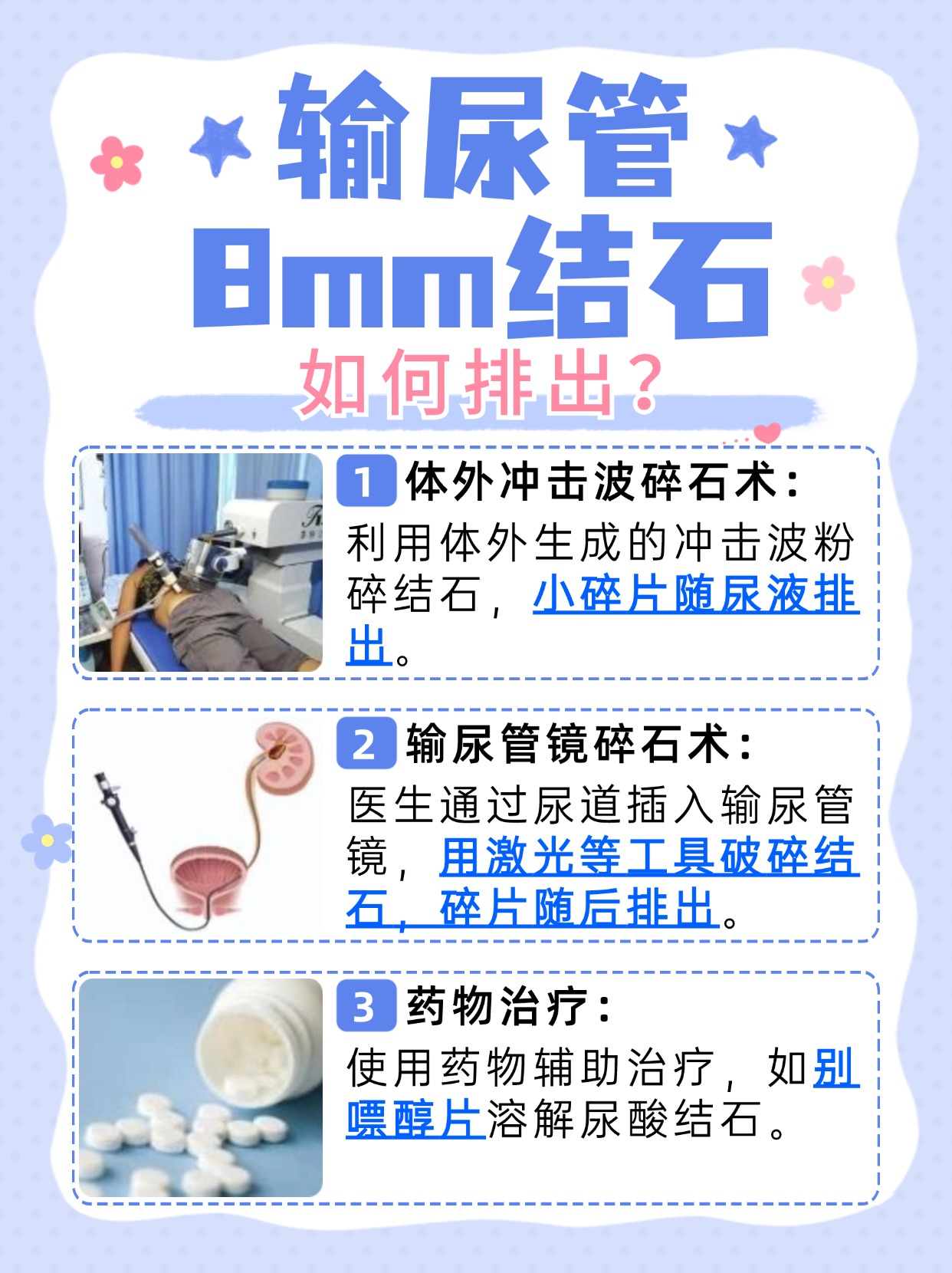 输尿管8mm结石,可以这样排出!