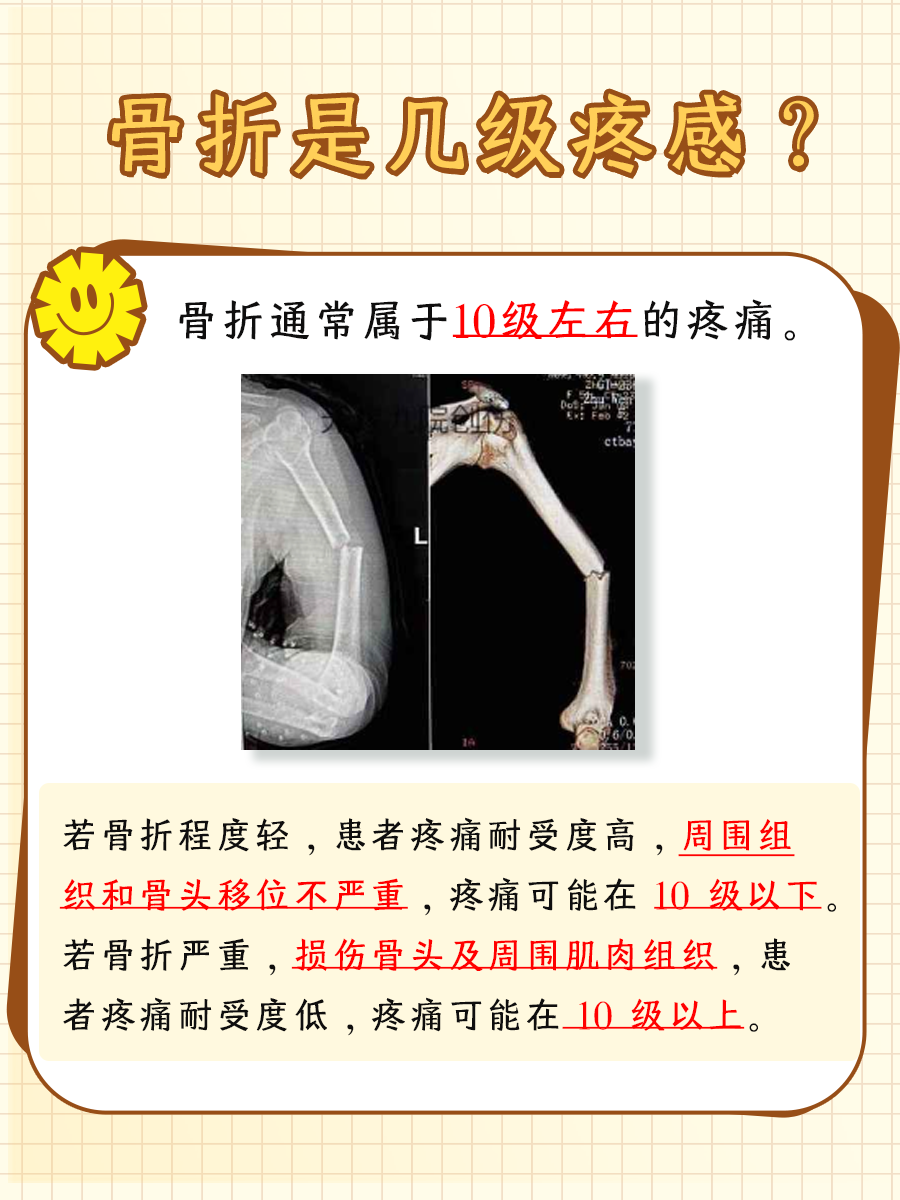 一文解析,骨折是几级疼感