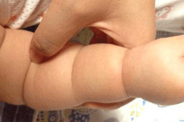 婴儿莲藕臂图 婴儿莲藕臂图