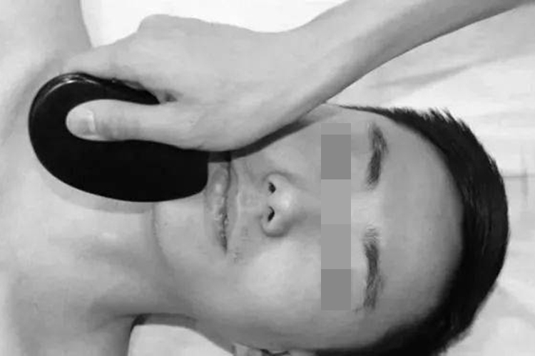 刮痧板竖刮示意图