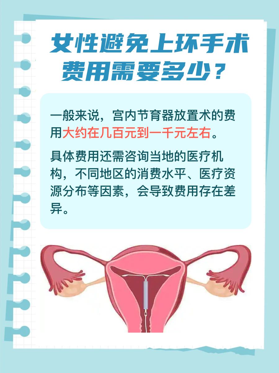 避孕选择经济账：上环手术费用全解析
