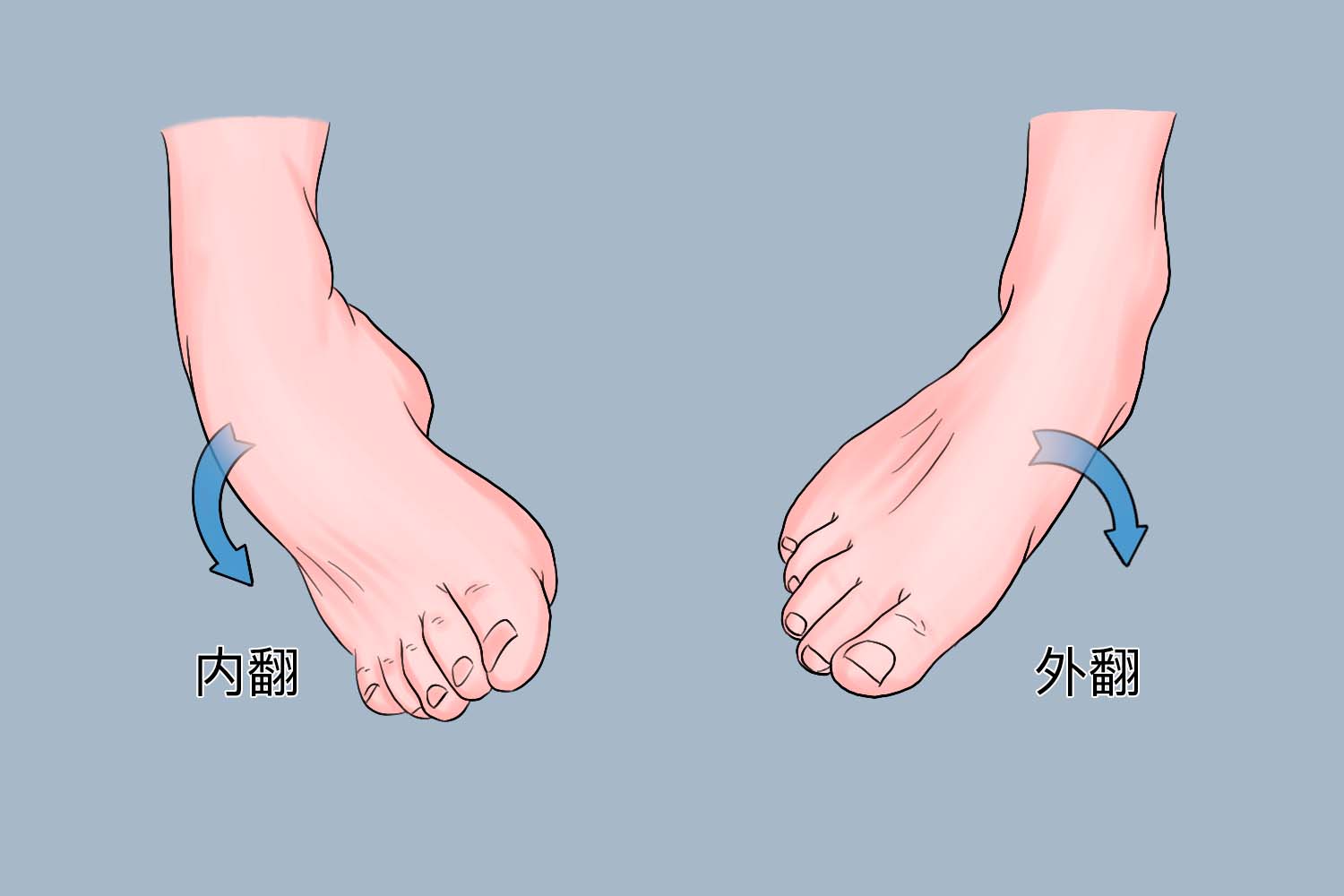 髋内翻和髋外翻图片图片