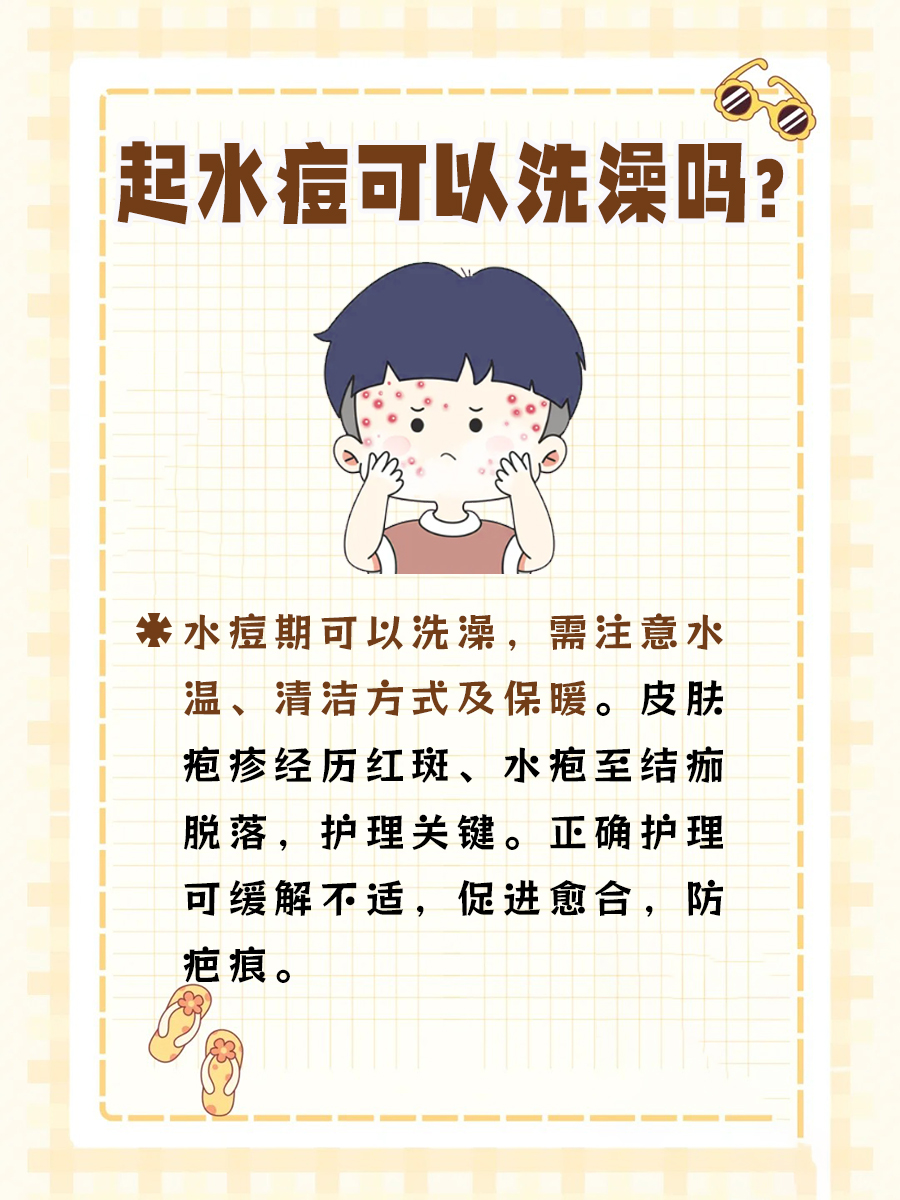 起水痘能洗澡吗？注意这些细节！