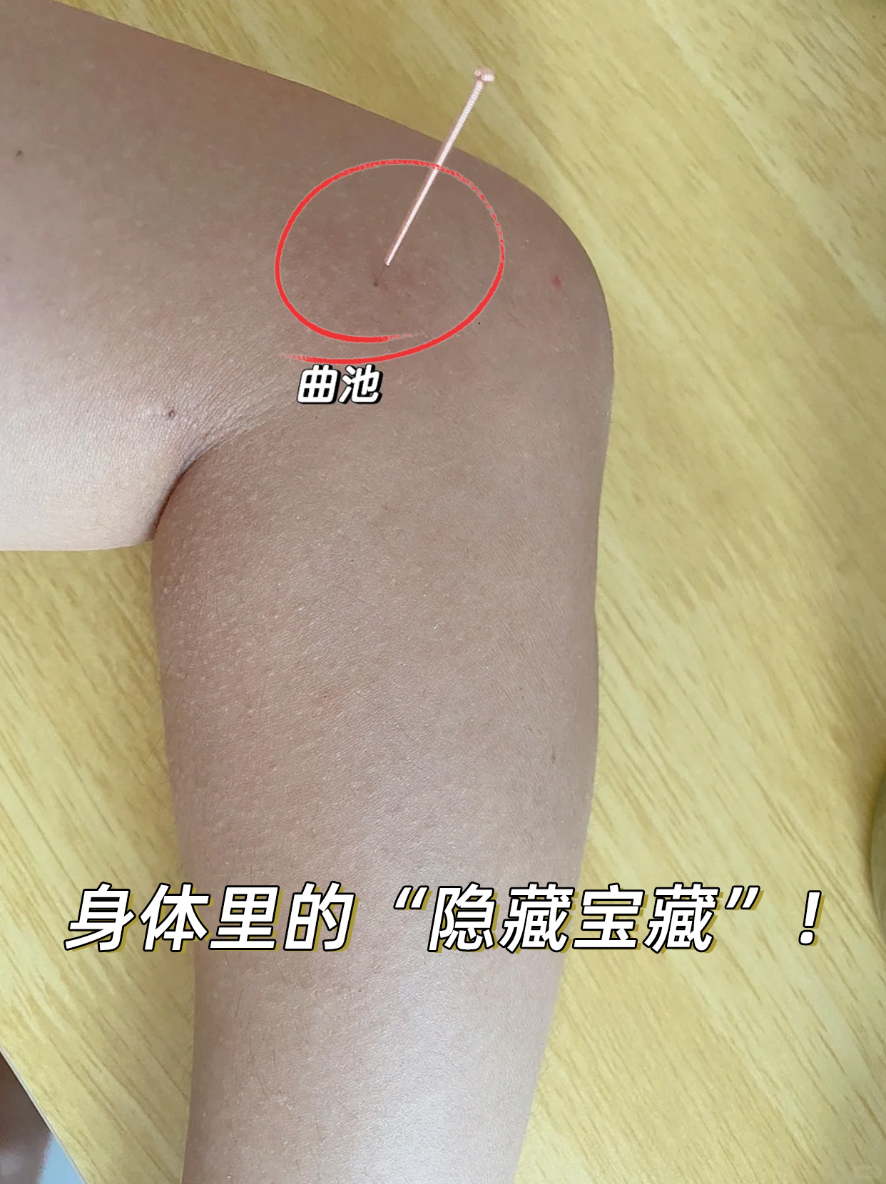 图文详解！告诉你曲池的准确位置！