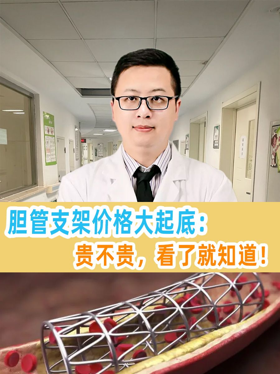 胆管支架价格大起底：贵不贵，看了就知道！