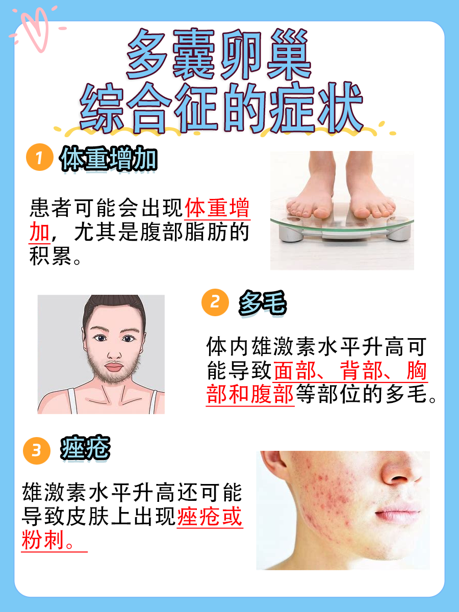 多囊卵巢综合征治疗：药物调理方案一览！