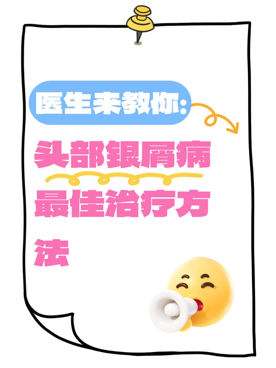 医生来教你:头部银屑病最佳治疗方法
