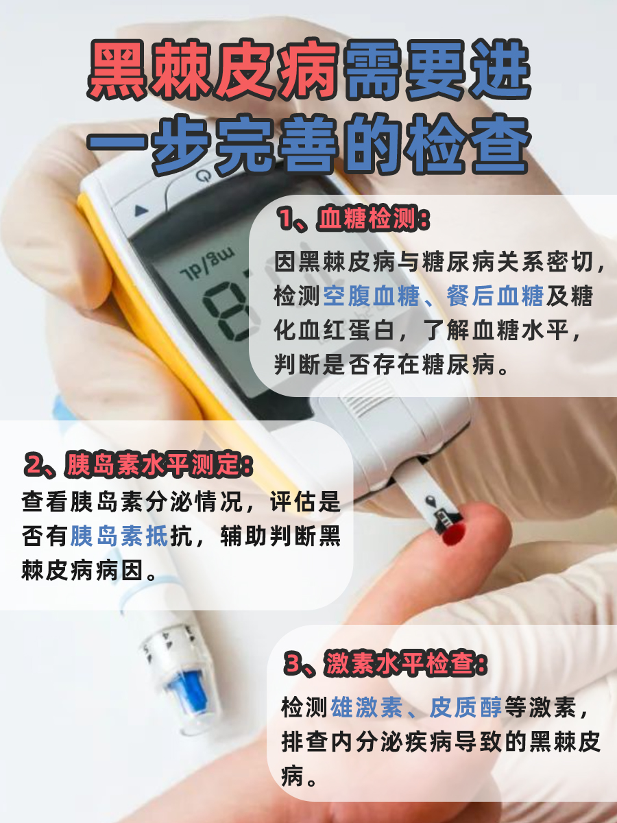 求解真相！黑棘皮病到糖尿病，间隔多久？