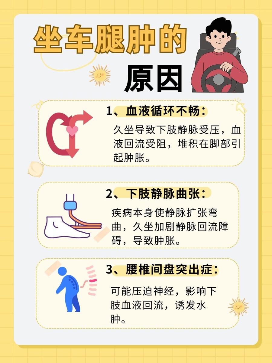 坐车腿肿的原因，你了解多少？