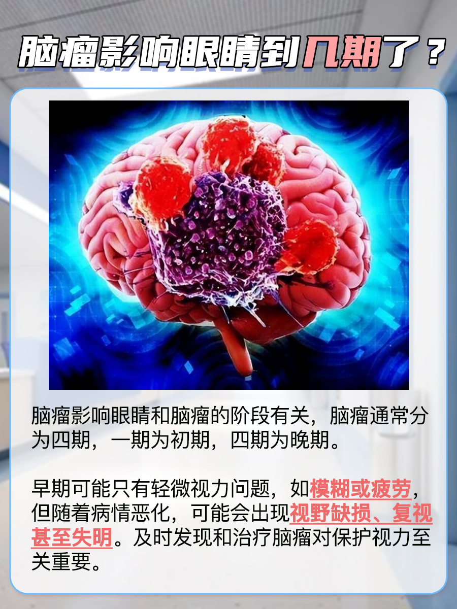 脑瘤悄悄逼近：你的眼睛发出了哪些预警信号