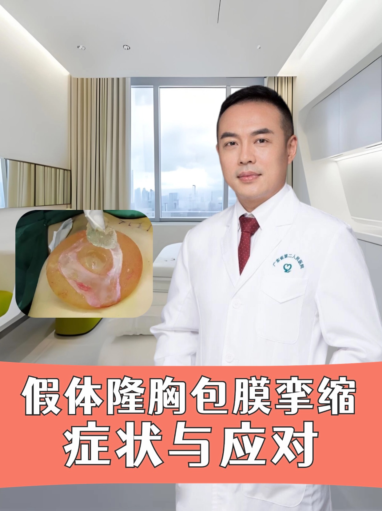 假体隆胸包膜挛缩：症状与应对