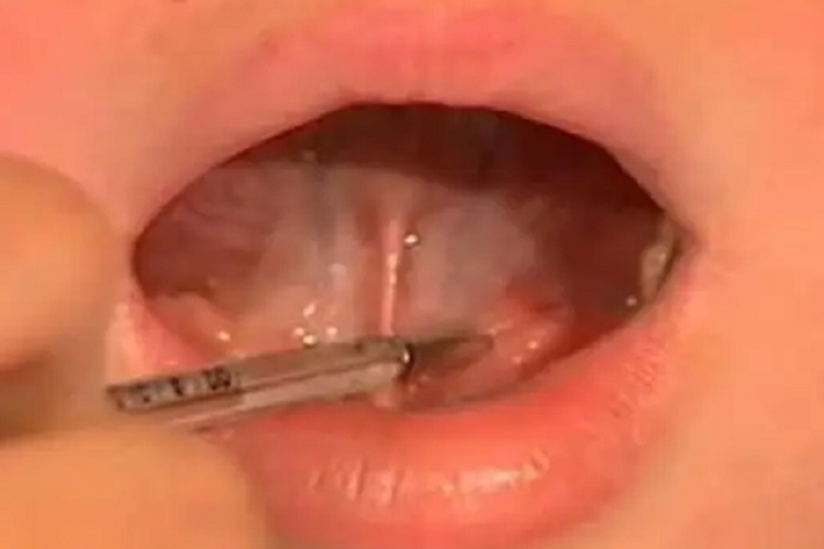 体温计放在舌下图 体温计放在舌下图