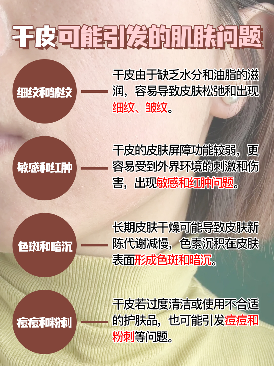 注意!干皮不重视这些,肌肤问题更严重
