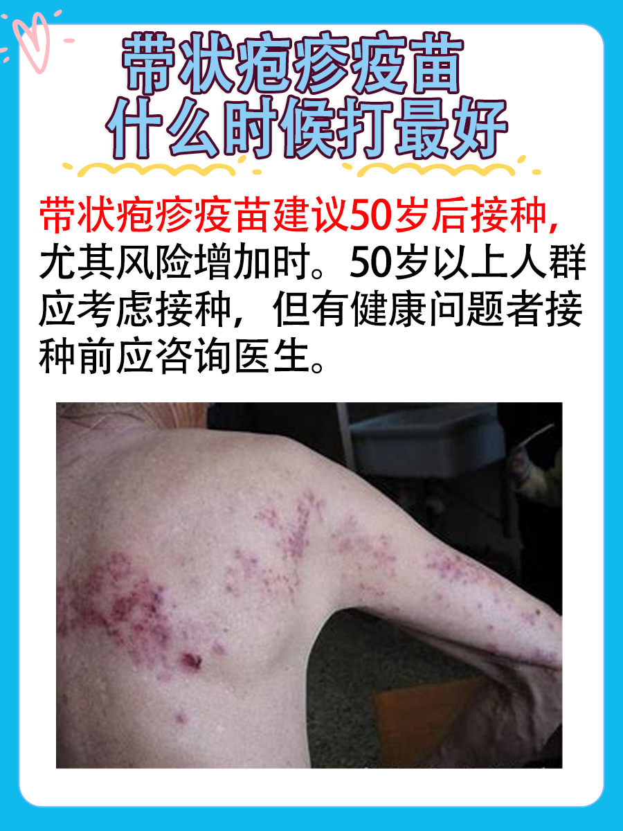 带状疱疹疫苗最佳接种时间，你了解吗？