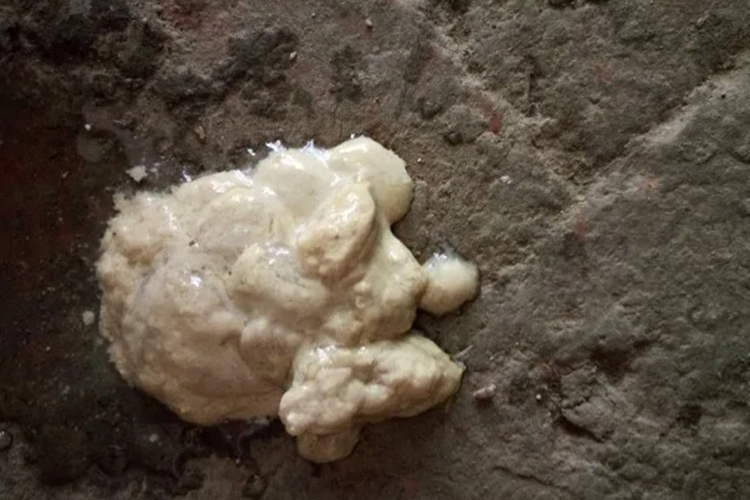 白色脂肪凝固样大便图