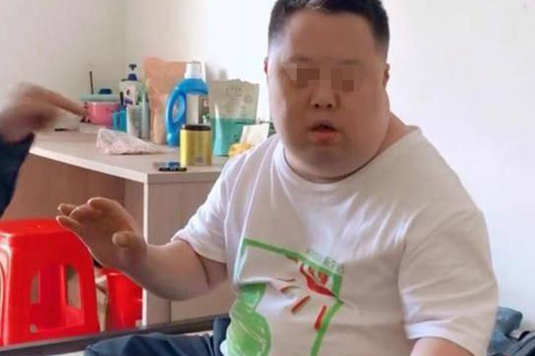 唐氏综合征表情呆滞图