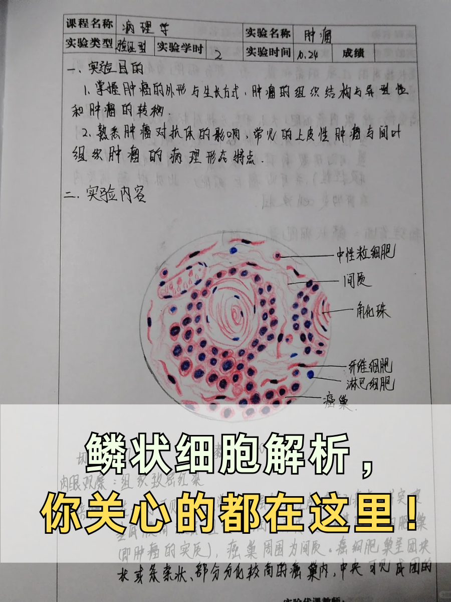 鳞状细胞解析，你关心的都在这里！